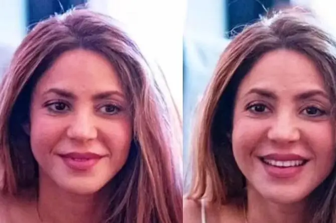 El 'nuevo' rostro de Shakira ¡La tunden en redes! (+fotos)